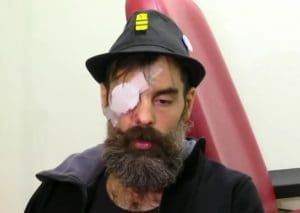 Lire la suite à propos de l’article Procès criminel pour le policier accusé d&rsquo;avoir éborgné Jérôme Rodrigues lors des manifestations des Gilets Jaunes