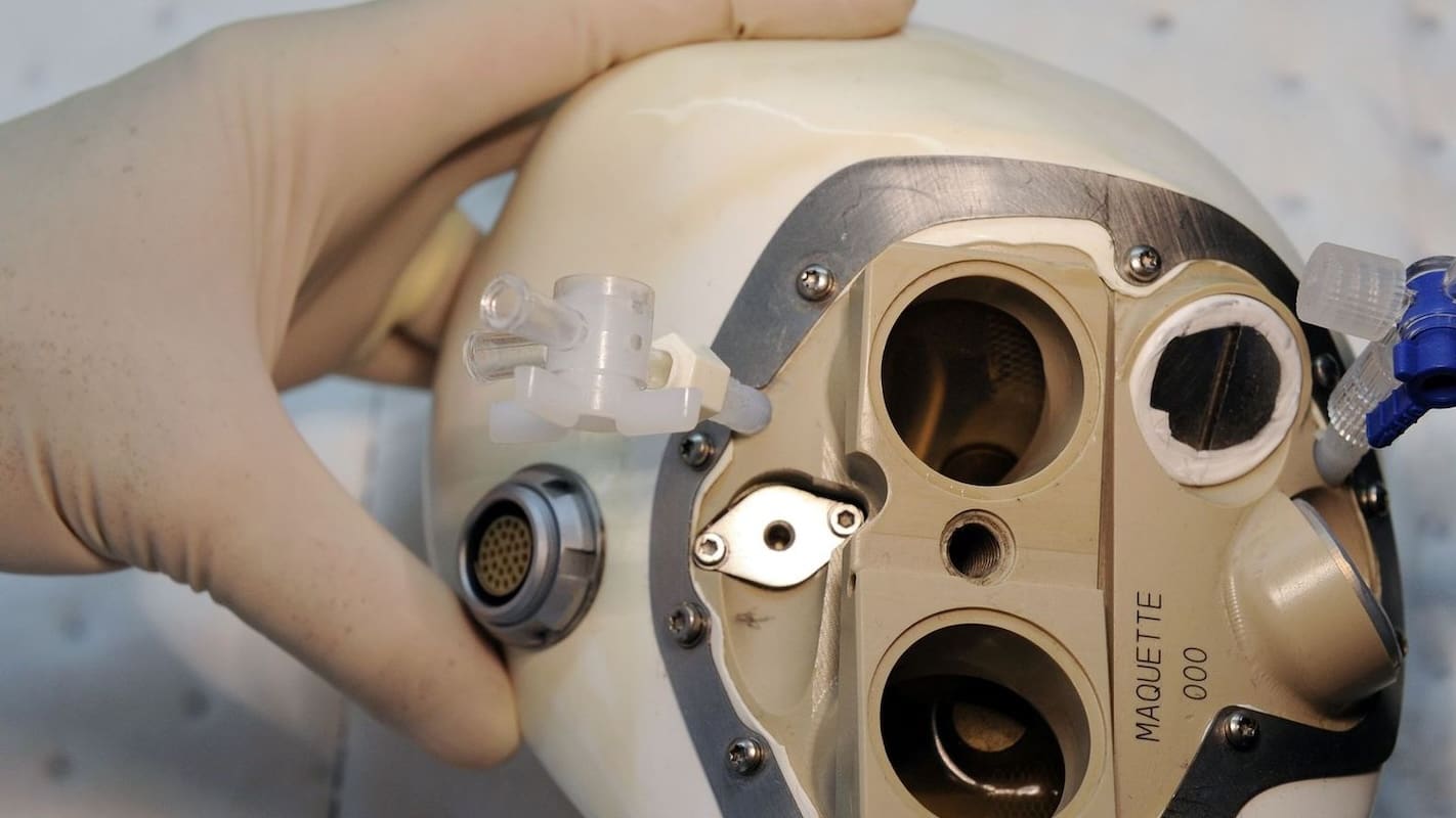 You are currently viewing Carmat, pionnier du cœur artificiel, se déclare en cessation de paiements