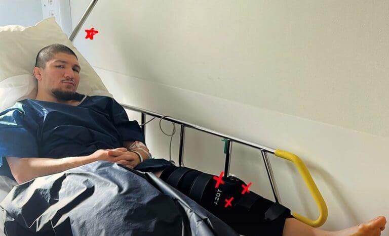 Lire la suite à propos de l’article MMA : Baki rassure ses fans après son opération du genou, objectif retour à 100 %