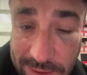 Lire la suite à propos de l’article Val d&rsquo;Oise : Anthony Joubert agressé dans un TER avant un spectacle