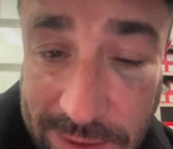 Lire la suite à propos de l’article Val d&rsquo;Oise : Anthony Joubert agressé dans un TER avant un spectacle