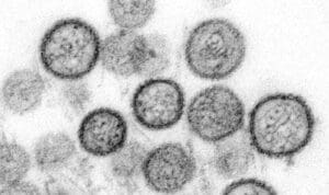 Lire la suite à propos de l’article Vaccin hantavirus : les pistes prometteuses qui pourraient rapidement voir le jour