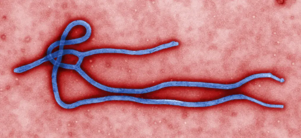 Virion du virus Ebola
