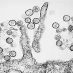 Micrographie électronique du hantavirus Sin Nombre