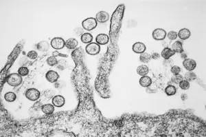 Lire la suite à propos de l’article Hantavirus en France : comment le système sanitaire prépare le rapatriement des passagers