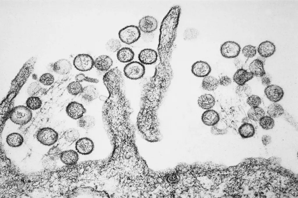 Image en microscopie électronique du hantavirus Sin Nombre (CDC)