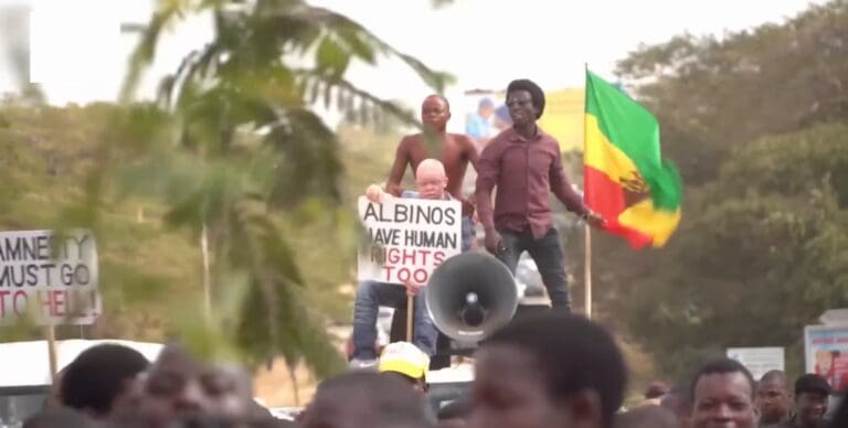 Lire la suite à propos de l’article Madagascar : les enlèvements et assassinats d’enfants albinos se poursuivent malgré les appels internationaux