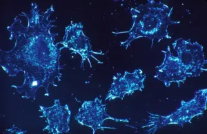 Lire la suite à propos de l’article Cellules cancéreuses : un antioxydant pour désarmer l’immunité