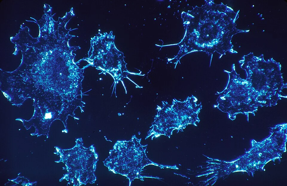 Cellules cancereuses observees au microscope en contraste de phase