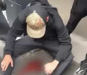 Lire la suite à propos de l’article Lycéen blessé à Tours : Maël, 16 ans, a perdu l’usage de son œil droit